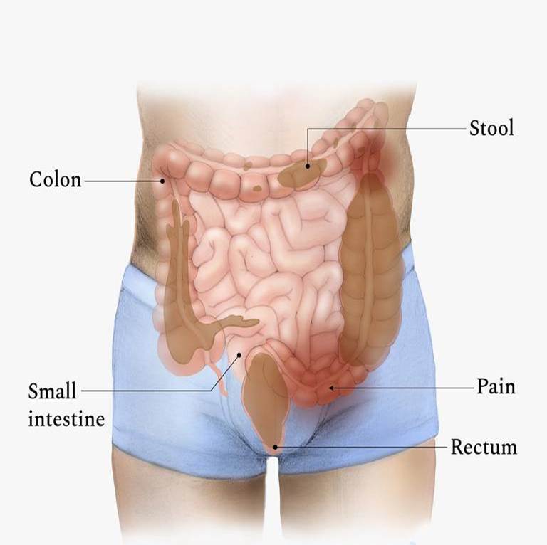 The Colon s Role